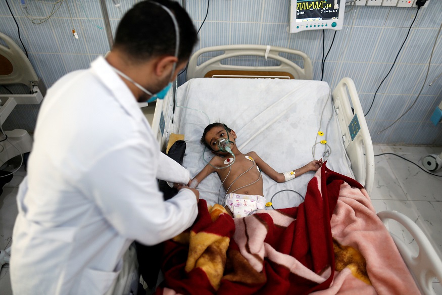 A nurse attends to a boy infected with diphtheria at the al-Sabeen hospital in Sana'a, Yemen.