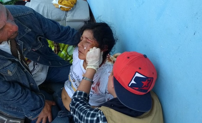 Colombian woman injured by public security forces in the Cauca Valley demonstrations in Cauca, Colombia, March 15, 2019.