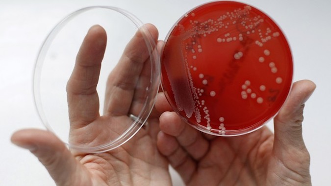 An employee displays MRSA (Methicillin-resistant Staphylococcus aureus) bacteria strain inside a petri dish in a microbiological laboratory in Berlin.