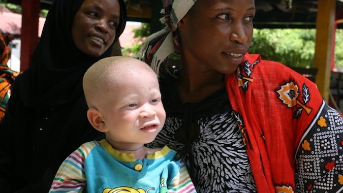A woman holds her albino child before registering him at the office of the Tanzania Albino Society (TAS) in Dar Es Salaam.