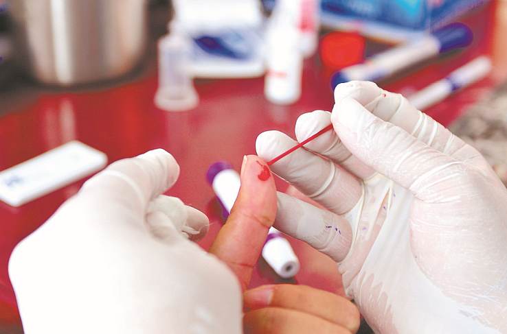 A free HIV test carried out by the government in Nicaragua