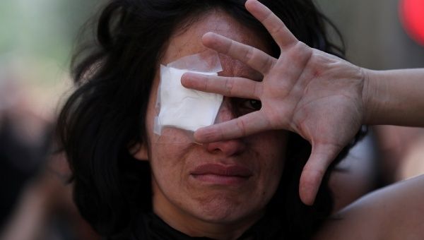 A performer wearing an eyepatch covers her face as part of a protest supporting people who have lost an eye during protests in Santiago, Chile, Nov. 12, 2019.