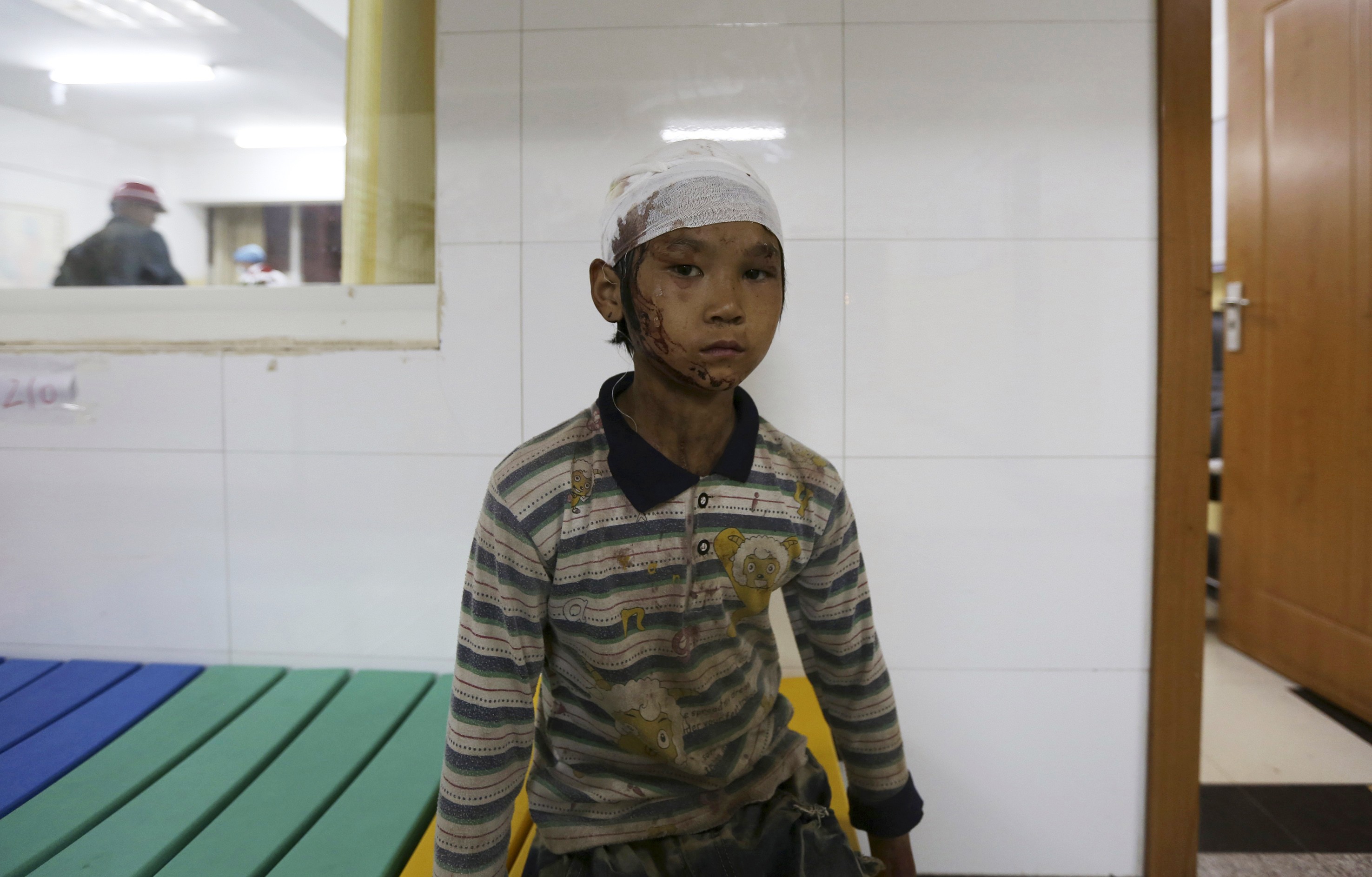 Yang Hongshun, 9, is seen at a hospital after he was injured during the earthquake in Yunnan province, Sunday (Photo: Reuters)