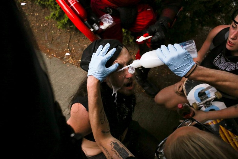 Medics help a protester who was sprayed by police pepper spray.