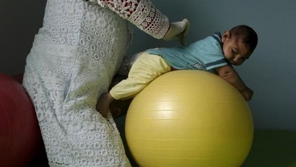 A physiotherapist exercises with a 4-month-old born with microcephaly in Pedro I hospital in Campina Grande, Brazil , Feb. 17, 2016.