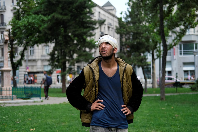 An injured refugee stands in a park during an event to mark World Refugee Day in Belgrade, Serbia June 20, 2016.