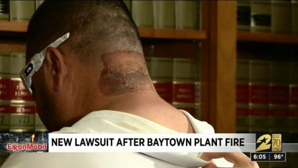 Alvaro Coronel showed his injuries to KPRC 2's report Bill Barajas in a report related to the lawsuit presented against ExxonMobil. 