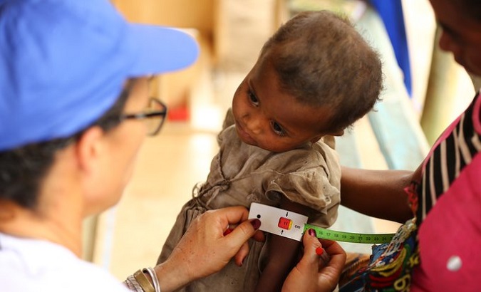 A child undergoes a malnutrition test in Madagascar, 2020.