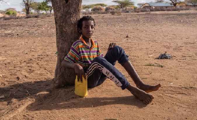 An African boy suffering from the impacts of drought, 2022.