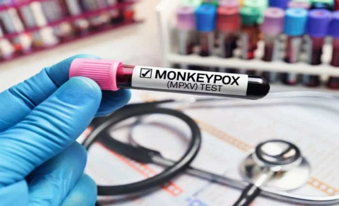 Last week, China reported the first and so far only case of monkeypox recorded in the southwestern municipality of Chongqing. Sep. 19, 2022.