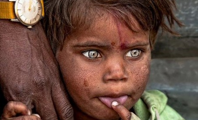 A kid in Yemen.