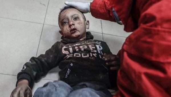 A Palestinian children injured during bombings by Israeli occupation forces in Gaza, Nov. 2023.