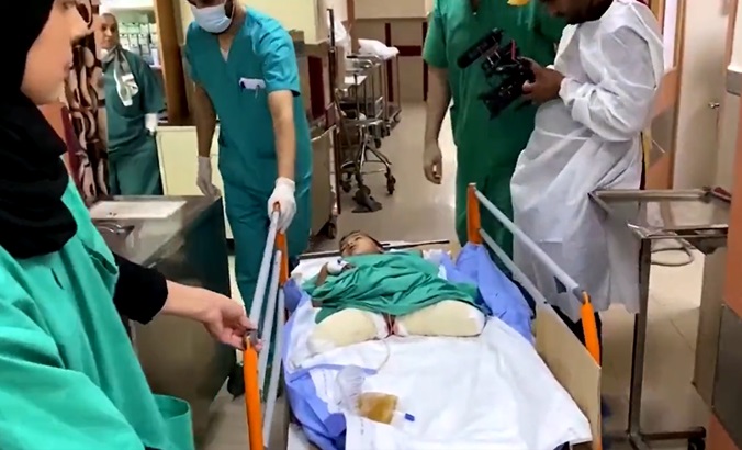 Palestinian boy with both legs amputated in Gaza, 2023.