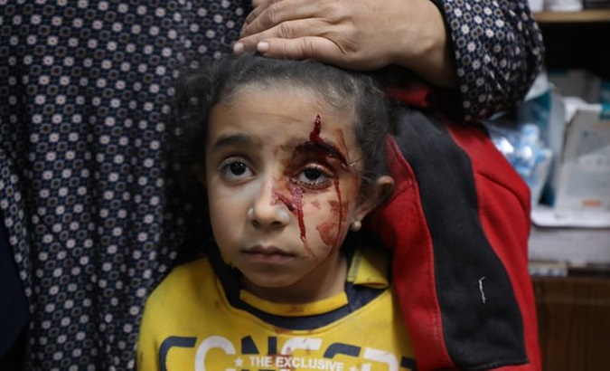 A victim of the Israeli bombings in Gaza, Feb, 2024.