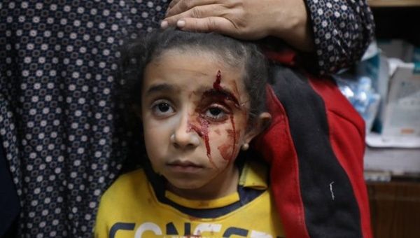 A victim of the Israeli bombings in Gaza, Feb, 2024.