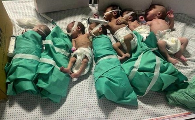 Babies in Gaza suffering of malnutrition, Feb. 28, 2024