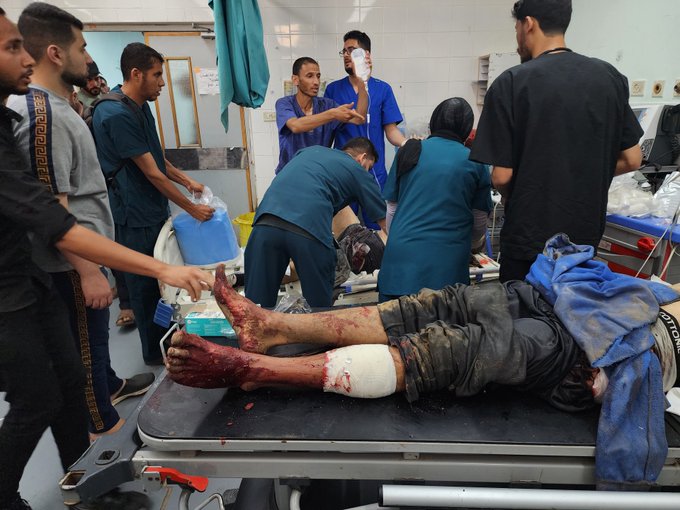 Gaza´s population suffering due to the Israel Attacks, May 28, 2024